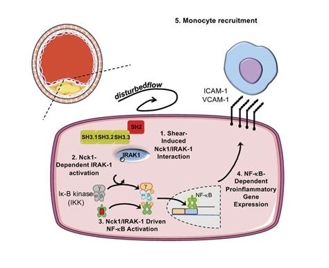 JCI - Selective role of Nck1 in atherogenic inflammation and plaque formation