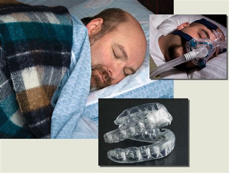 Small device helps sleep apnea sufferers in a big way | Mission magazine | UT Health Science ...