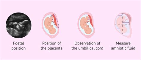 Fetal ultrasound in the third trimester of pregnancy