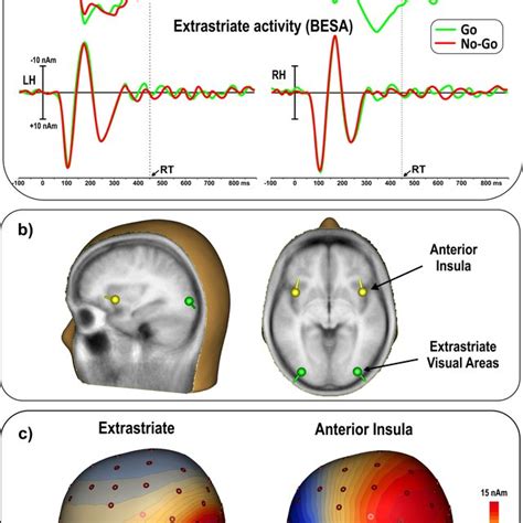 Time course of bilateral anterior insula activation in case of SRT and ...