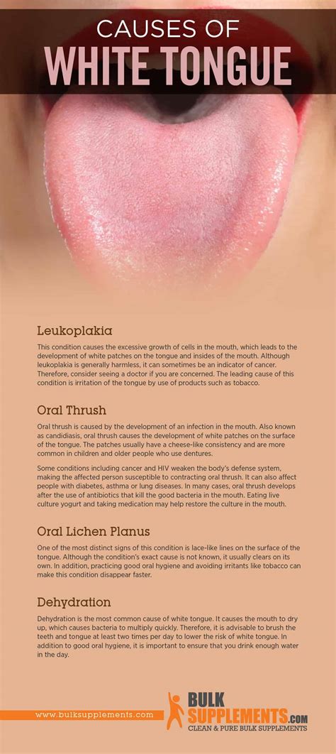 White Tongue: Symptoms, Causes & Treatment