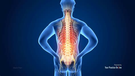 Back Pain Wallpapers - Top Free Back Pain Backgrounds - WallpaperAccess