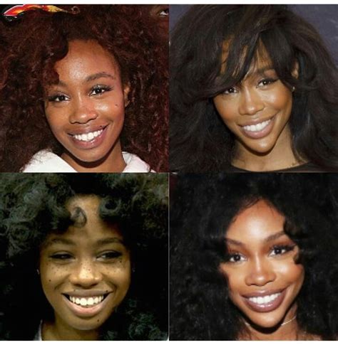 Sza Before And After Plastic Surgery: Everything You Need To Know!