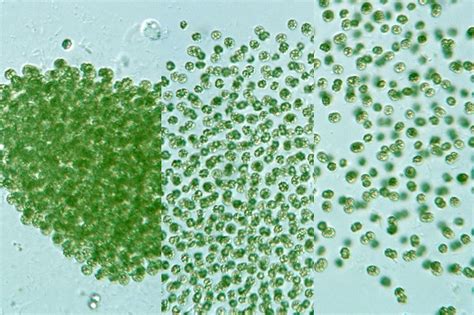 Microcystis