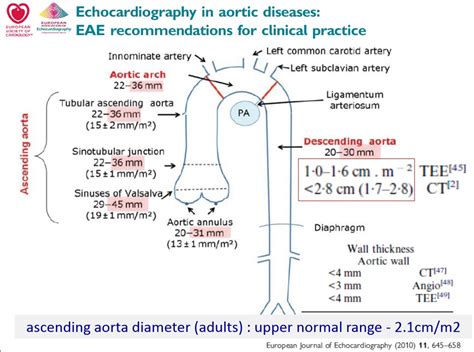 Typical size of an aorta. : 네이버 블로그