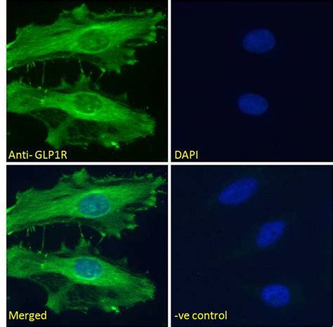 Anti-GLP1R / GLP-1 Receptor Antibody | Goat anti-Human Polyclonal | LSBio