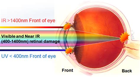 Wave Length Determines What Part Of The Eye Is Damaged Photo by madmacmo | Photobucket