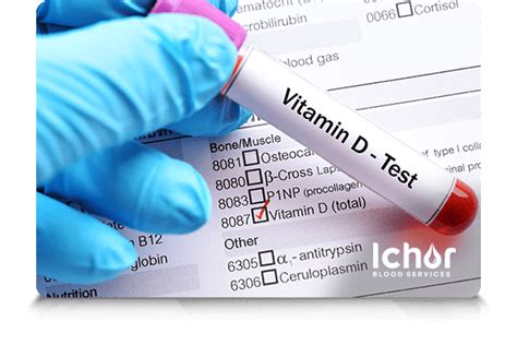 Vitamin D Testing | Vitamin D Tests | Vitamin D3 Testing