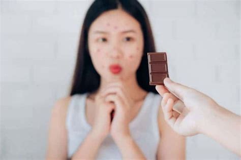 Chocolate Allergy Symptoms: 9 Shocking Symptoms