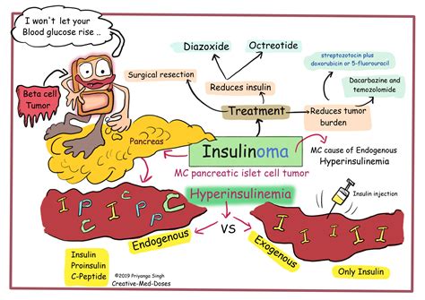 Insulinoma - Beta cell tumor - Creative Med Doses