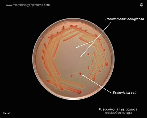 Pseudomonas aeruginosa on MacConkey agar. Colony appearance and morphology of P.aeruginosa ...