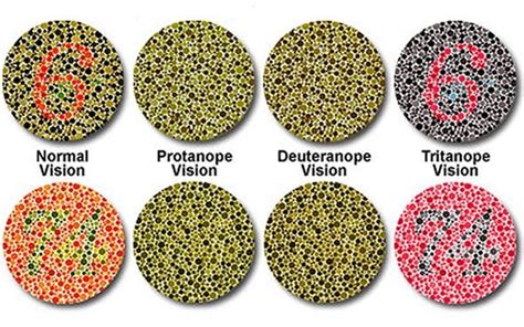 deutan color blindness comparison - Wilton Clemons