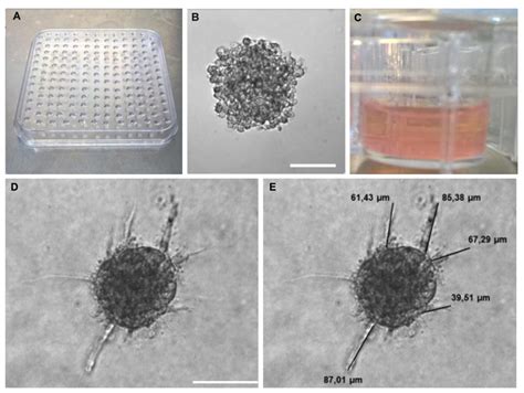 3D Angiogenesis Assay - Creative Bioarray CellAssay