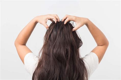 What Are the Causes of Excessive Dry Scalp? - Health n Well.com