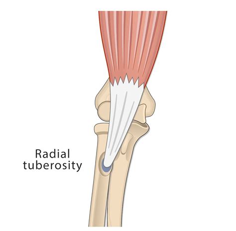 Radial Tuberosity