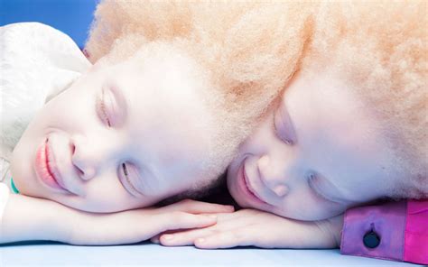 Meet The 11-Year-Old Albino Twins who Are Taking the Fashion World by Storm