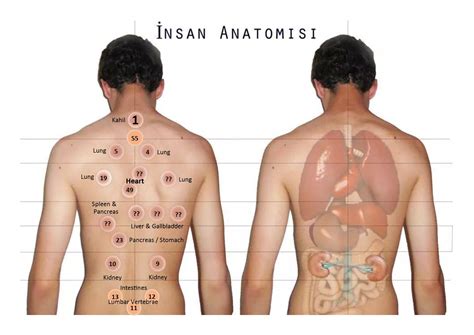 Some Hijama Points - Hijama Cupping London