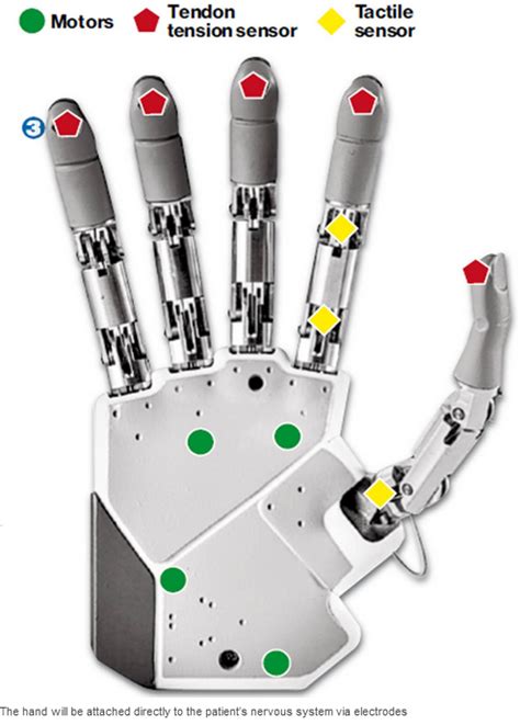 Bionic Hand That Offers Touch And Feel Real Time - Assistive Technology Blog