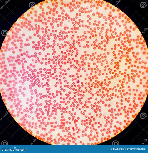 Human Blood Cells Under a Microscope Stock Photo - Image of blood, light: 85053122