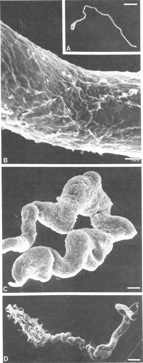 Scanning electron micrographs of isolated muscle fibers. (A) Relaxed... | Download Scientific ...