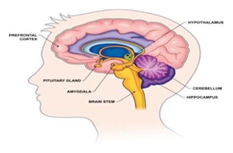 Pilocytic Astrocytoma