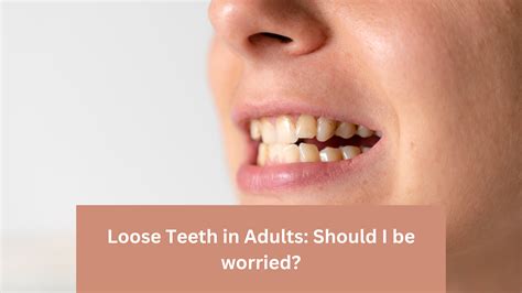 Loose Teeth in Adults: Should I be worried?