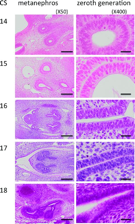 Renal pelvis epithelium (zeroth generation) between CS14 and CS23 ...