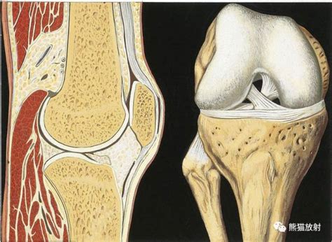 【解剖】膝关节系统解剖图+矢状MRI+示意图