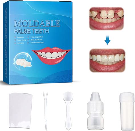 Moldable False Teeth, Kit Otturazione Denti, Cemento per Denti, Kit di ...