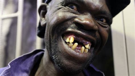 top most ugliest people in the world | Ugliest People: ये हैं दुनिया के ...