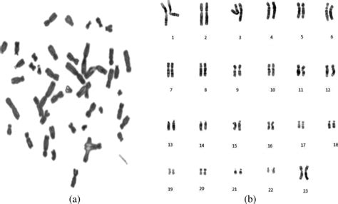 Metaphase image and its corresponding karyotype image courtesy:... | Download Scientific Diagram