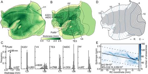 Cortical thickness. A : Map of the cortical thickness projected onto a ...