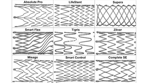 Nitinol Stent Manufacturer : SHANGHAI MEDICAL