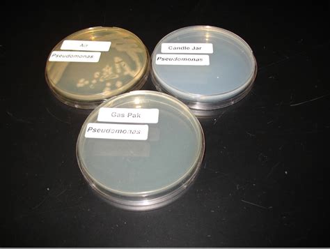 EFFECT OF OXYGEN ON BACTERIAL GROWTH – Red Mountain Microbiology