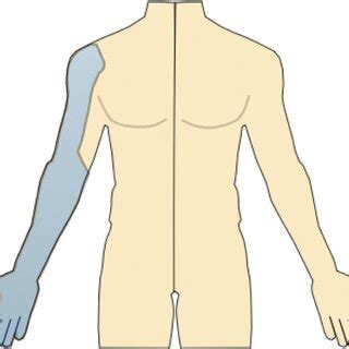 Axillary Nerve Block Anatomical Distribution. | Download Scientific Diagram