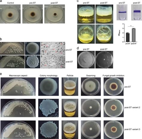 How to Differentiate Between Bacteria and Fungus Under the Microscope