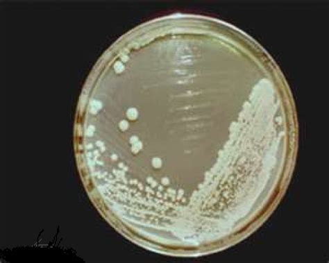 Yeast (Saccharomyces cerevisiae) » BioTek