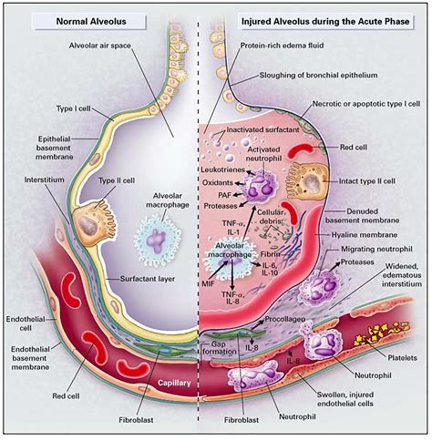 Frontiers | Metabolic Imaging and Biological Assessment: Platforms to Evaluate Acute Lung Injury ...