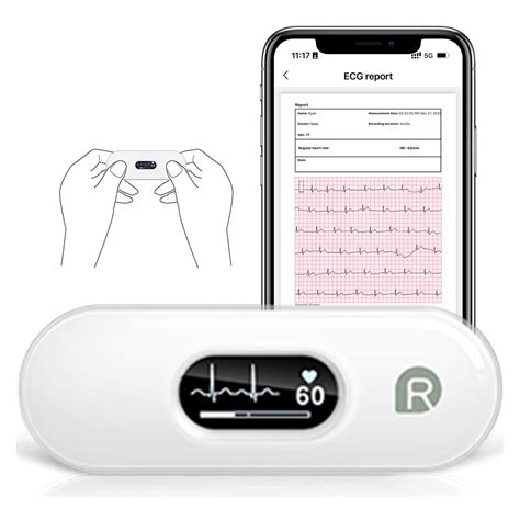 Wellue Monitor ECG Mobili DuoEK-S, Sensore Cardiaco ECG Portatile Wireless Bluetooth con Display ...