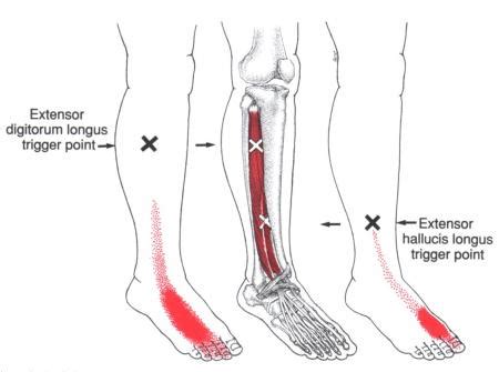 Ankle and Foot Pain – Massage Therapy Connections