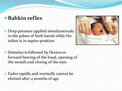 Reflexes present in infants