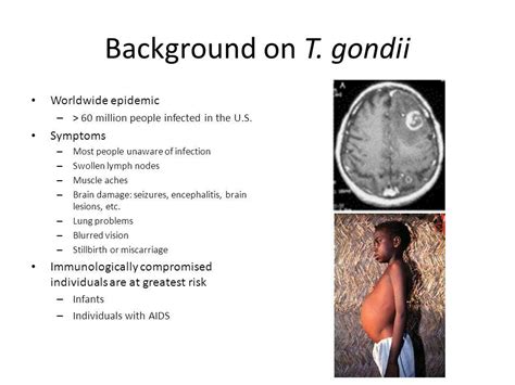 Toxoplasma Gondii: Clinical Findings - Parasitic Infections - AntiinfectiveMeds.com