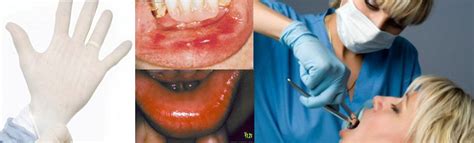 Allergy Concerns at the Dentist | St. Lawrence Dentistry | Dentist, Allergies, Dentistry