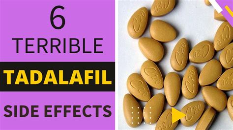 6 TERRIBLE TADALAFIL SIDE EFFECTS - YouTube