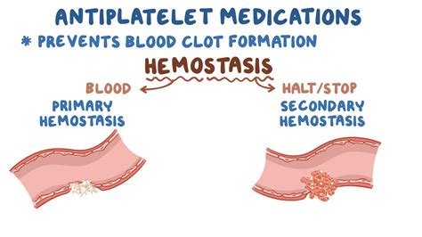 Antiplatelet medications: Video, Anatomy & Definition | Osmosis