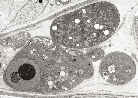 Apoptosis Photograph by Microscape/science Photo Library - Pixels