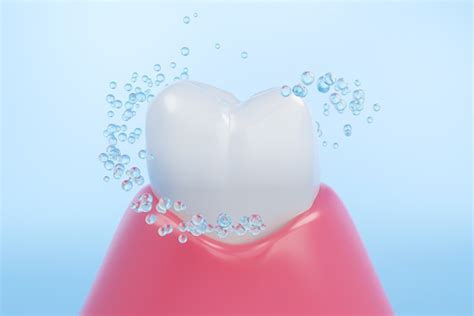 4 Things a Dental Cleaning Can Prevent - CDC Dental Center North Hollywood California