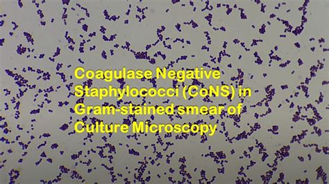 Coagulase Negative Staphylococci (CoNS) in Gram stained smear of ...