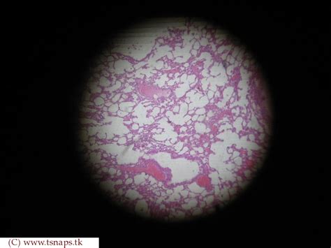 Histology Slides Database: human lung histology slides