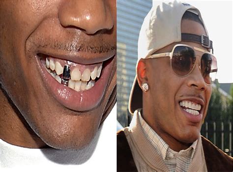 Celebrity Teeth – What They Looked Like Before & After! | Celebrity teeth, Teeth makeover ...